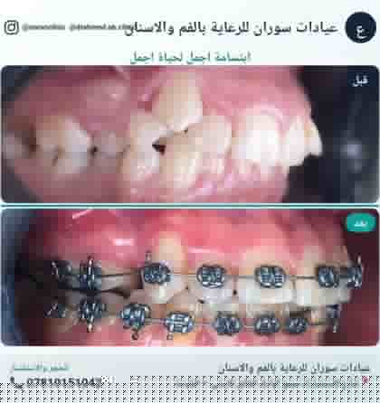حالة تقويم