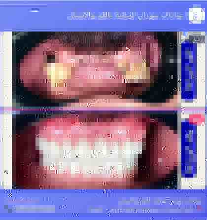 زراعة وتعويض
