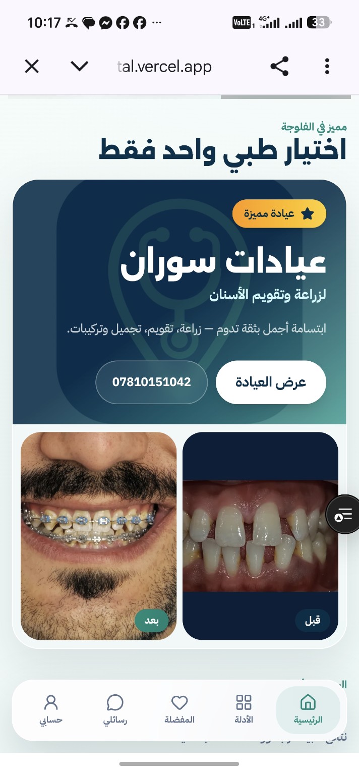 متابعة إغلاق الفراغات — قبل العلاج